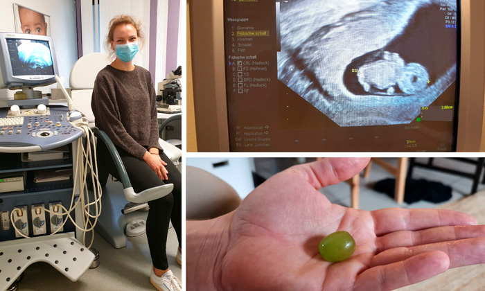 Drei Trimester einer Schwangerschaft